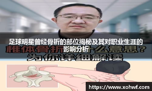 足球明星曾经骨折的部位揭秘及其对职业生涯的影响分析